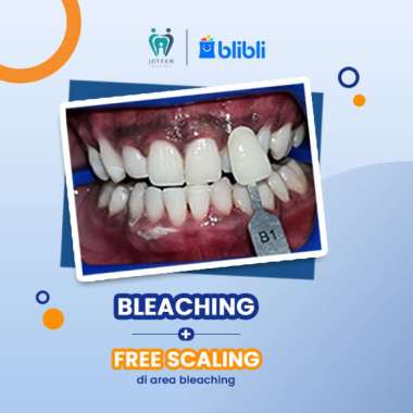 JOYFAM - BLEACHING GIGI